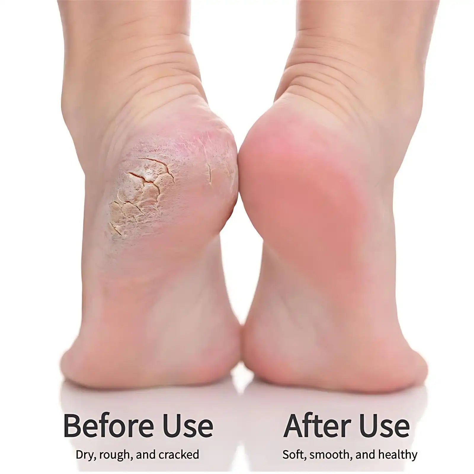 9-Speed Professional Electric Callus Remover & Foot Smoother