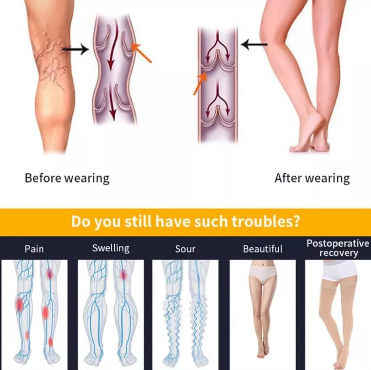 ROYALUCK Thigh High Compression Stockings 15-21mmHg Gradient Support Compression Hosiery